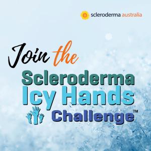 Icy Hands Challenge